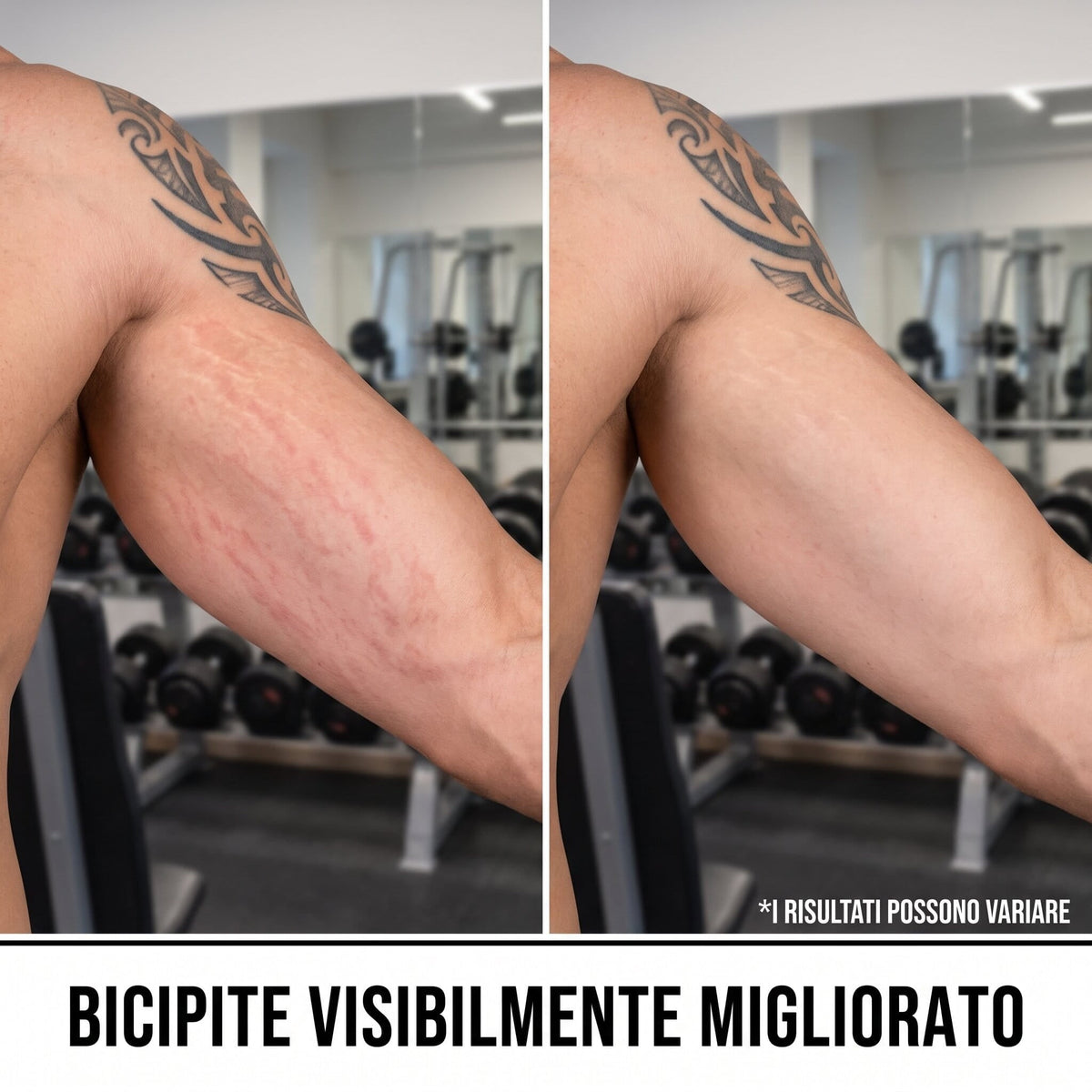 Siero anti smagliature